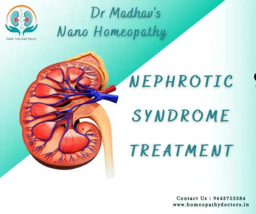 Nephrotic Syndrome treatment service image